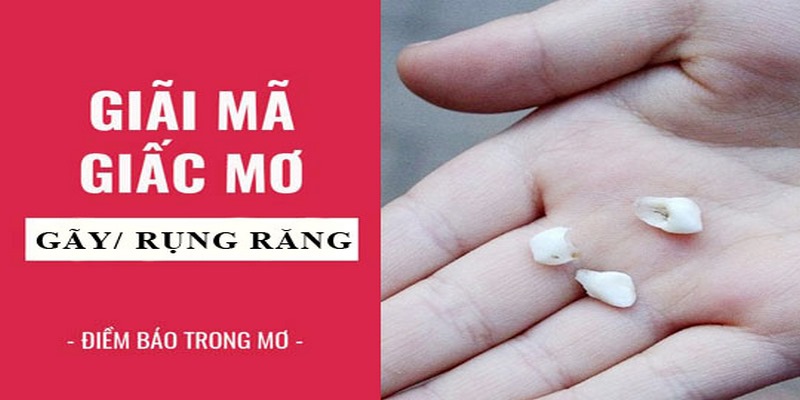 Mơ Thấy Răng Rụng Có Ý Nghĩa Như Nào? Con Số Nào May Mắn?
